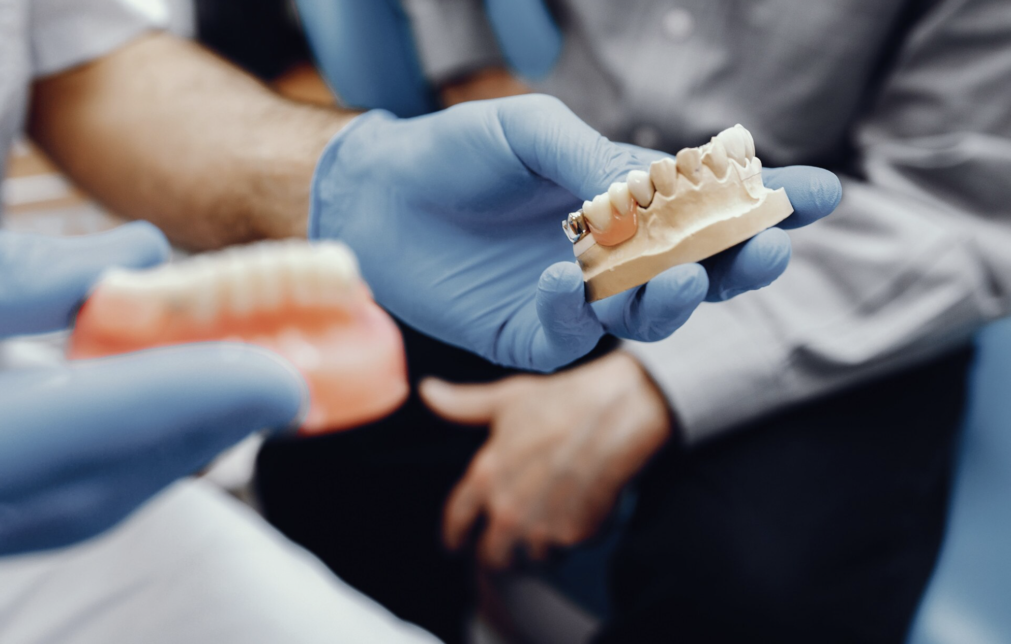 Diş Tedavilerinde Sıkça Sorulan Sorular: Yurt Dışından Gelen Hastalar İçin Bilgilendirme